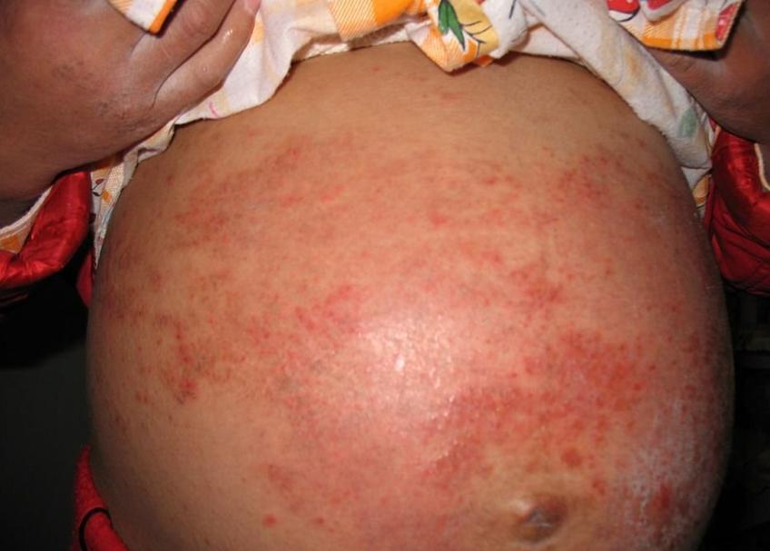 ʪ����շ���������Щ?