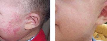 <a href=/szby/ target=_blank class=infotextkey>ʪ���</a>