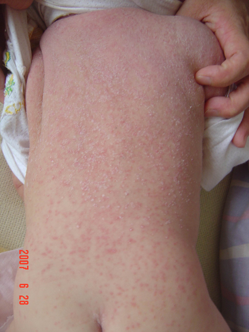 ʪ�����Σ���ź�����Щ