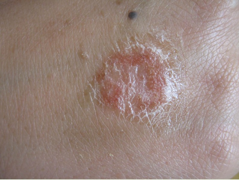 ��������ʪ���ԭ������Щ