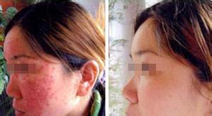 <a href=/szby/ target=_blank class=infotextkey>ʪ���</a>