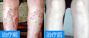 ʪ���ԭ��