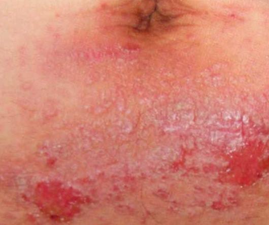 <a href=/szby/ target=_blank class=infotextkey>ʪ���</a>��ʲô