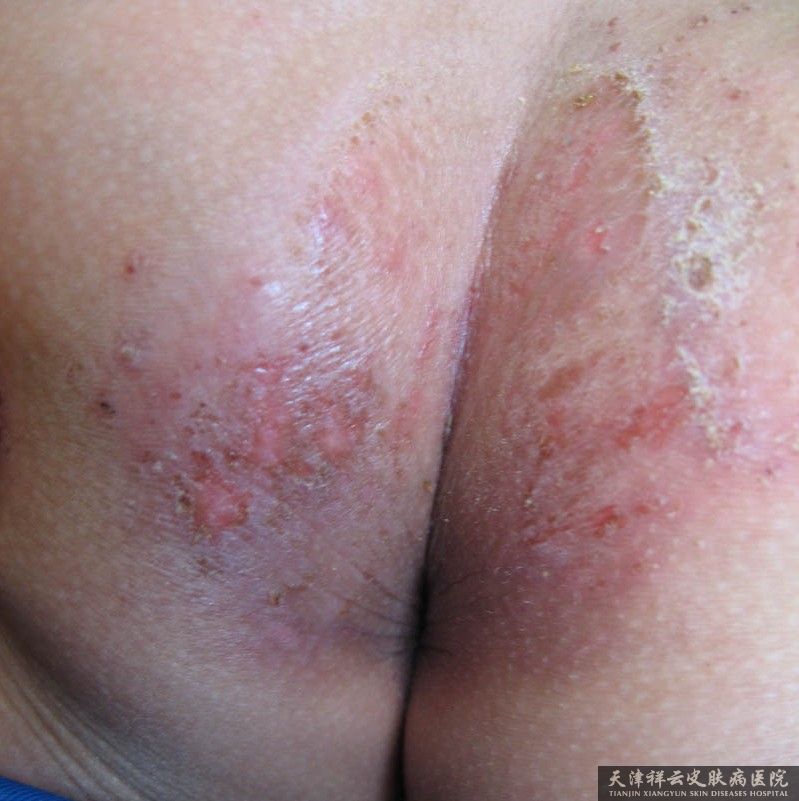 ����ʪ��