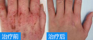 <a href=/szby/ target=_blank class=infotextkey>ʪ���</a>