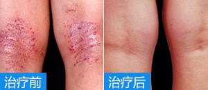 ʪ���շ�����