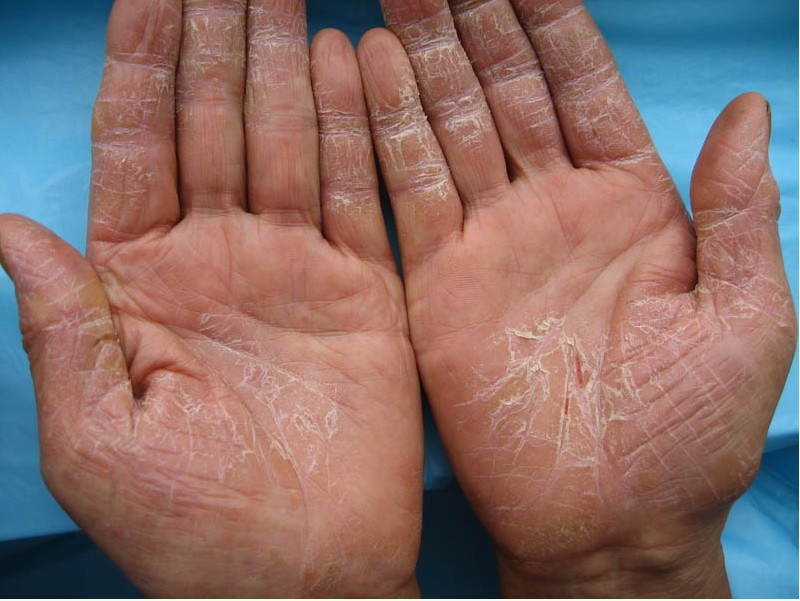 ����ʪ��