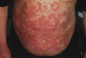 ��ҩ����ݡ����ҩ��