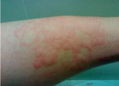 ��ҽ����ݡ�����