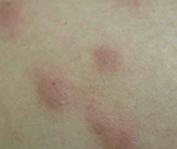 ��Ѫ�Ʒ���ݡ����