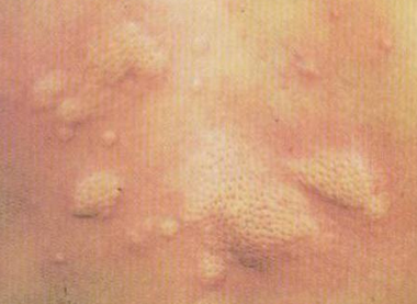 ����ݡ������ʲôƫ��