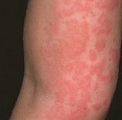 ��ҩ�ܳ����κ�ݡ������