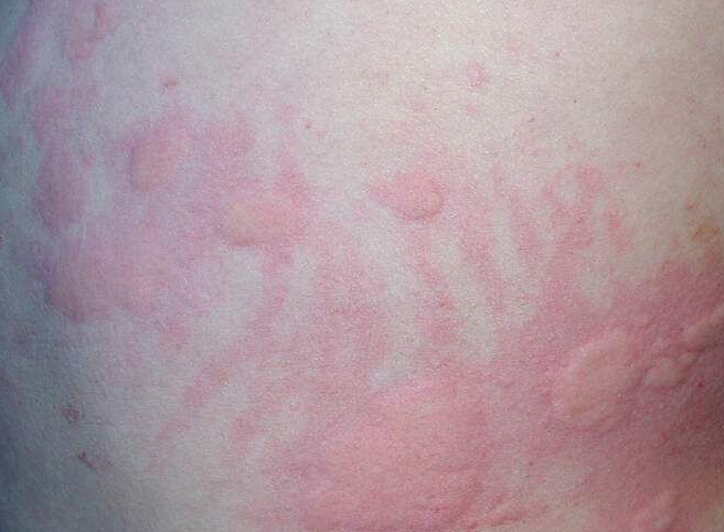 ��ҩ���������ݡ����