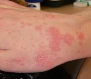 ������ݡ����ƫ��