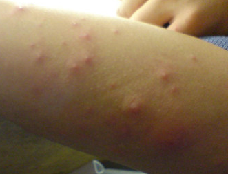 ��ҩ����ݡ����������