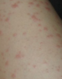 �����˹�ݡ������ҩ��