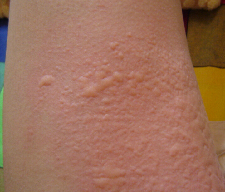 ����С��ݡ����ƫ��