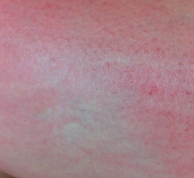 ����ݡ����ʪ���ƫ��