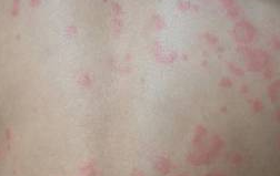 ��ݡ��������ҩ