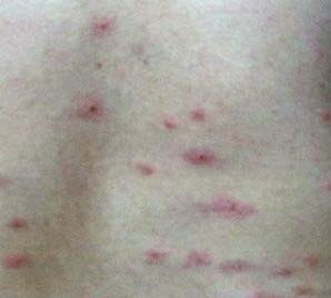 ��ݡ�������ҩ��һ������