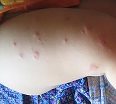 ��ҩ�ᵼ��ݡ����