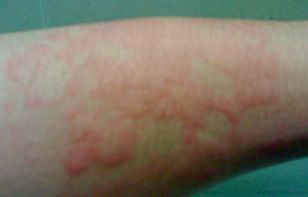 ��ҩƫ����ݡ����