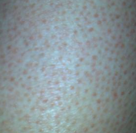 ����ݡ�����ʳ��