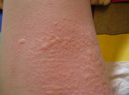 ����ݡ�������ҩƫ��