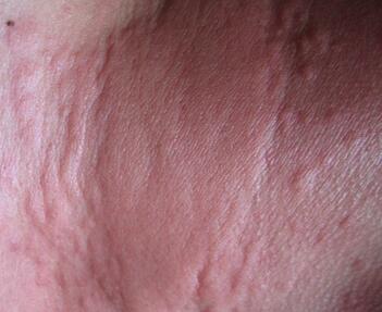 ��Ѫ����ݡ����